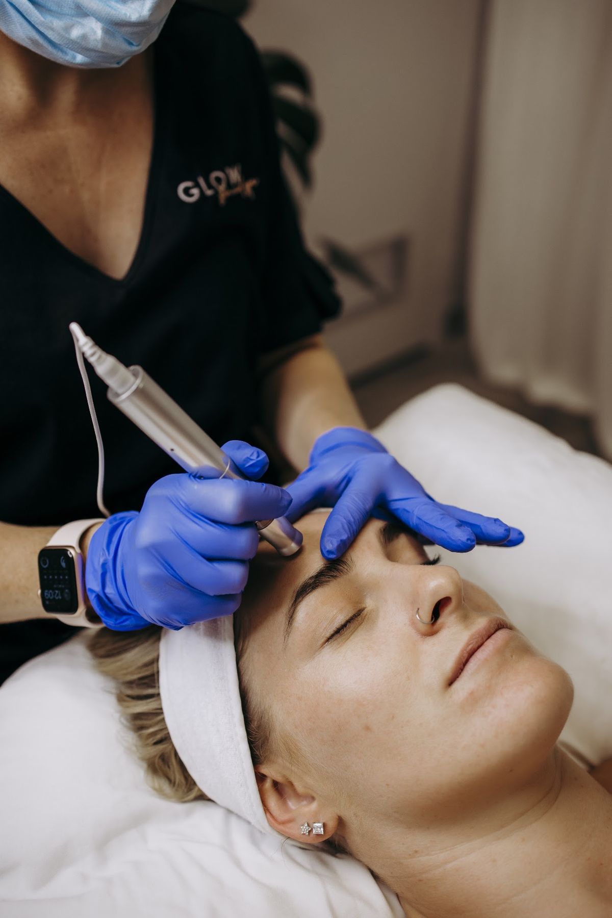 Skin needling treatment | Glow Skin & Spa, Baldivis